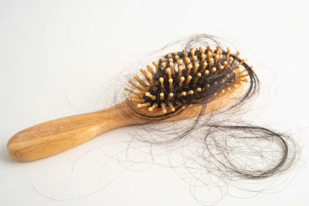 Comb with a lot of lost hair in and around it